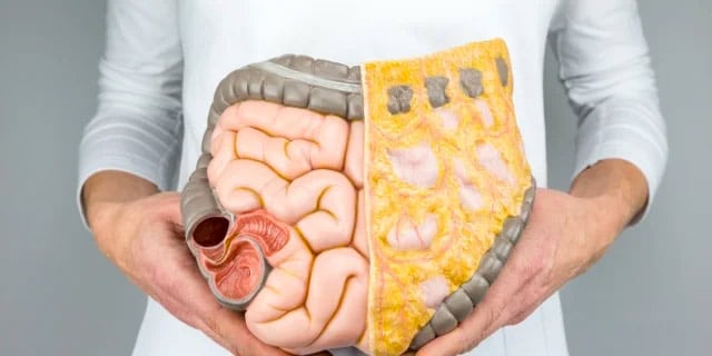 colon life size model